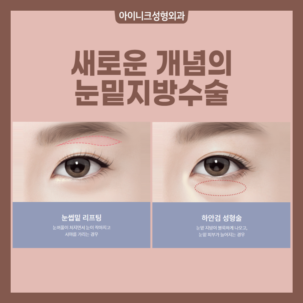 중년성형외과 확실한 효과를 원한다면? 관련 이미지 2