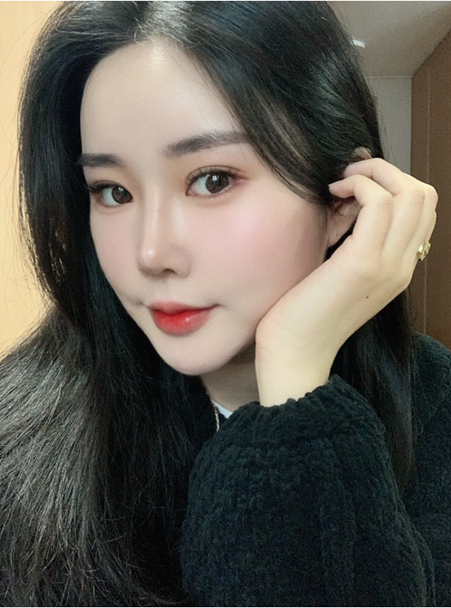 압구정 눈재수술 결정하기 전 꼭 체크할 네가지! 관련 이미지 1
