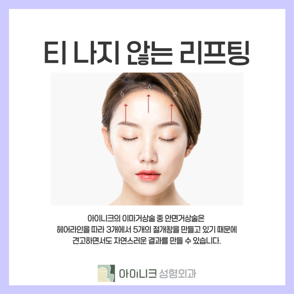 처진눈썹교정 방법 찾고 있을 때 관련 이미지 4