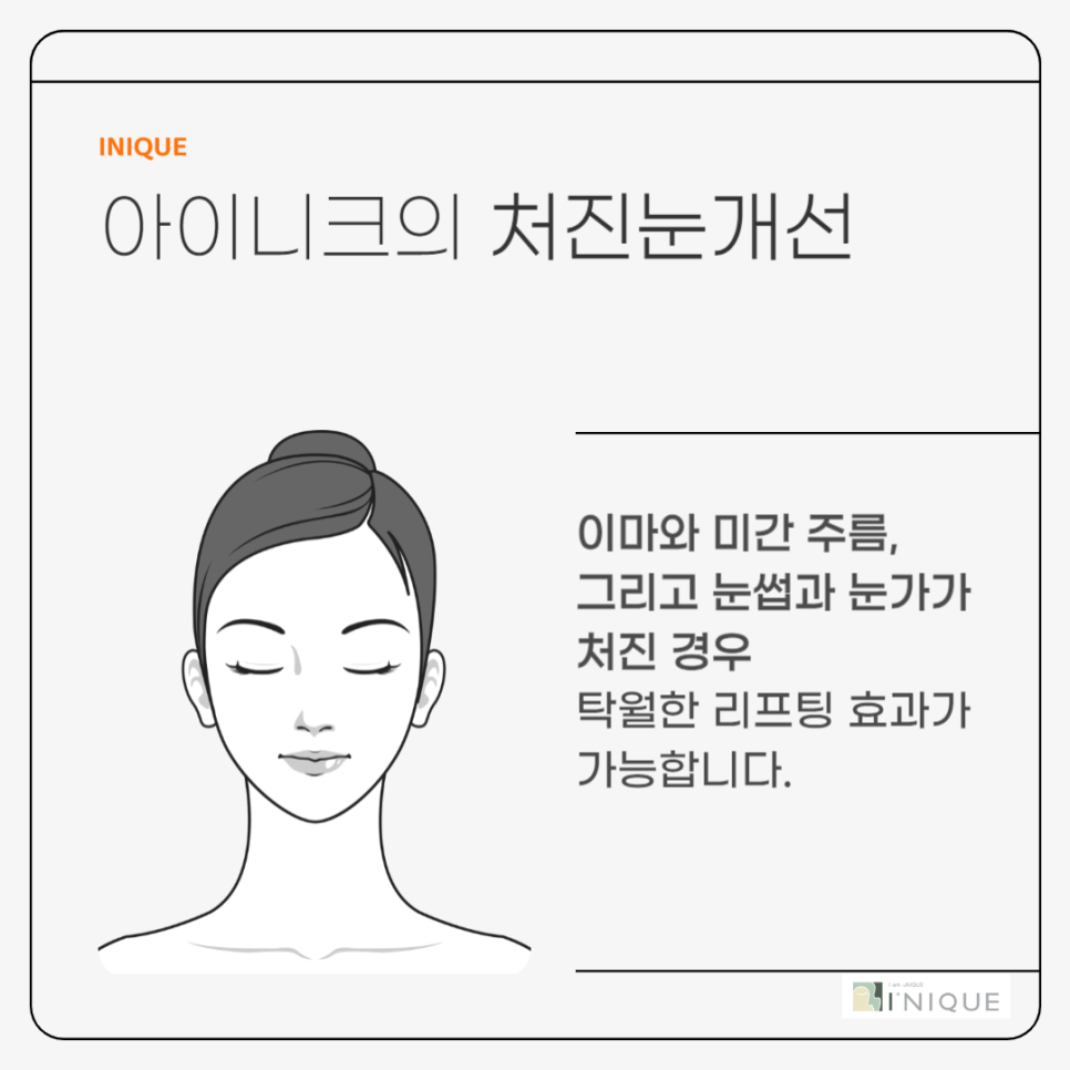 처진눈개선과 빠른 회복을 원한다면 관련 이미지 4