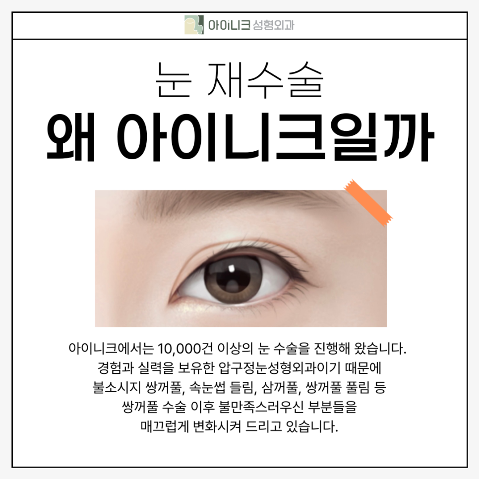 압구정눈수술 고민이라면 관련 이미지 5