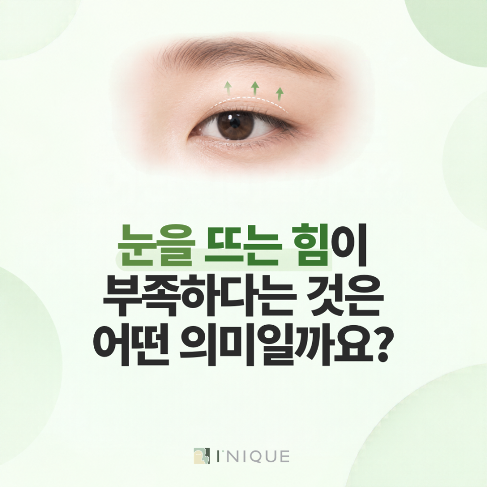 비절개눈매교정, 눈을 뜨는 힘부터 확인해야 하는 이유 관련 이미지 2