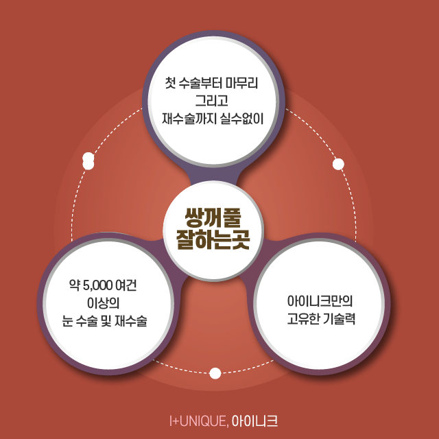 쌍꺼풀잘하는곳에는 다 방법이 있다, 어떤 것이 있을까 관련 이미지 6