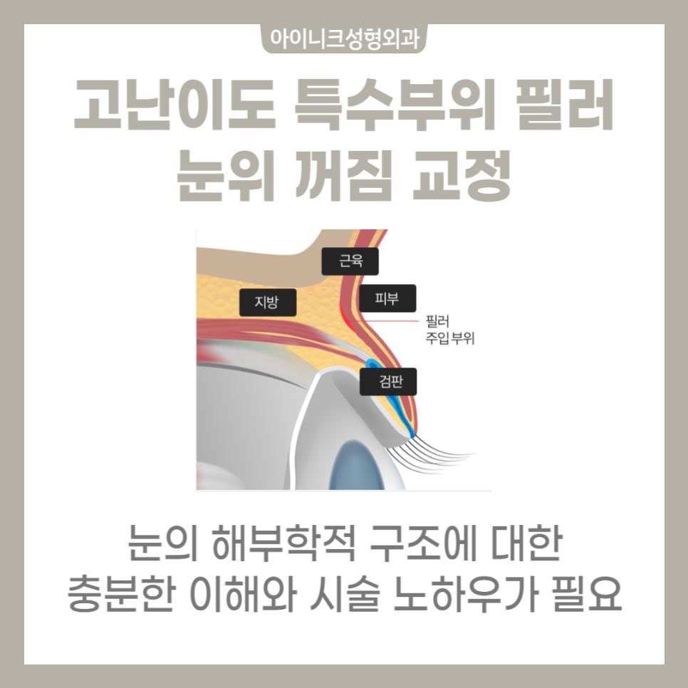 쁘띠성형종류 통증없이 잡는 얼굴라인 관련 이미지 3