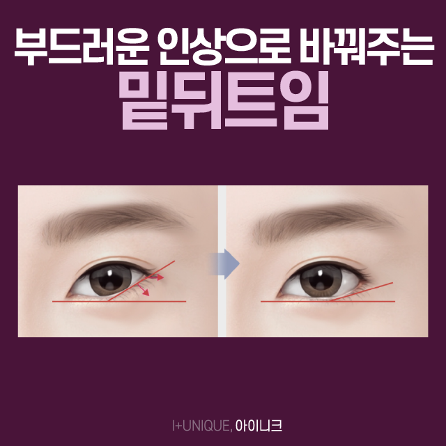 나의 눈과 어울리는 앞뒤트임을 원한다면? 관련 이미지 5
