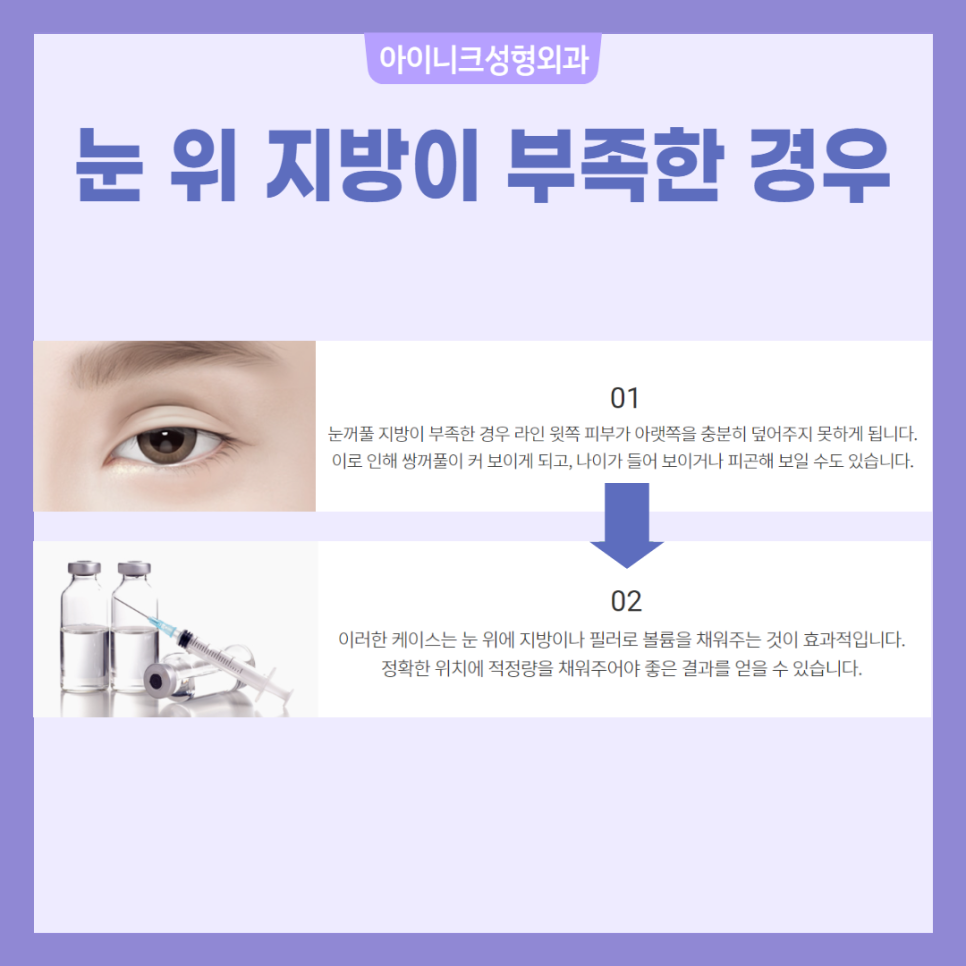 소세지쌍꺼풀 재수술 걱정 마세요! 관련 이미지 6