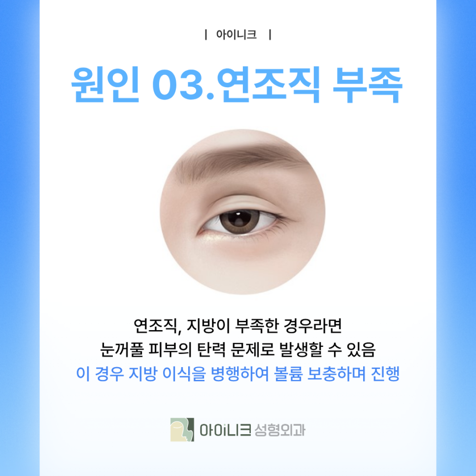 쌍꺼풀재수술병원 겹주름이 되어버렸다면? 관련 이미지 7