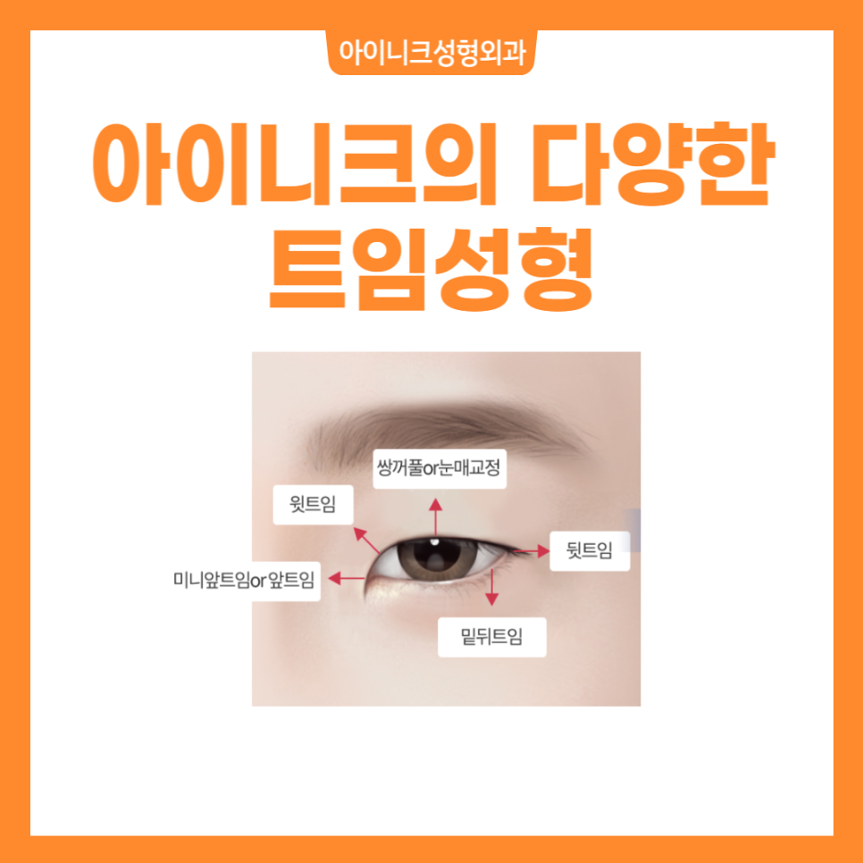 눈트임수술, 내 눈에 딱 맞게 선택하세요 관련 이미지 2