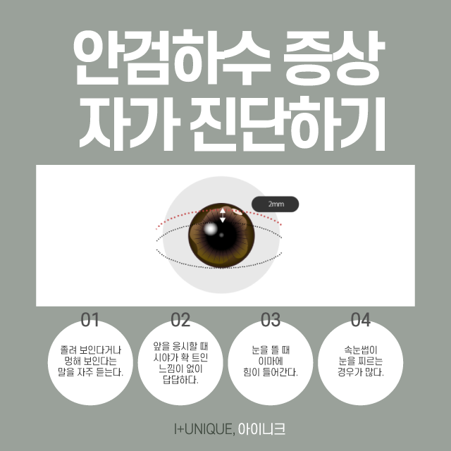 흐릿한 눈매가 고민인 여자분들, 비절개 눈매교정술 상담 받으세요! 관련 이미지 2