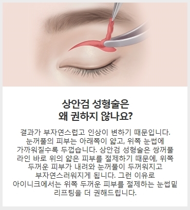 중년쌍꺼풀수술 눈썹밑 리프팅으로 깨끗하게 관련 이미지 4