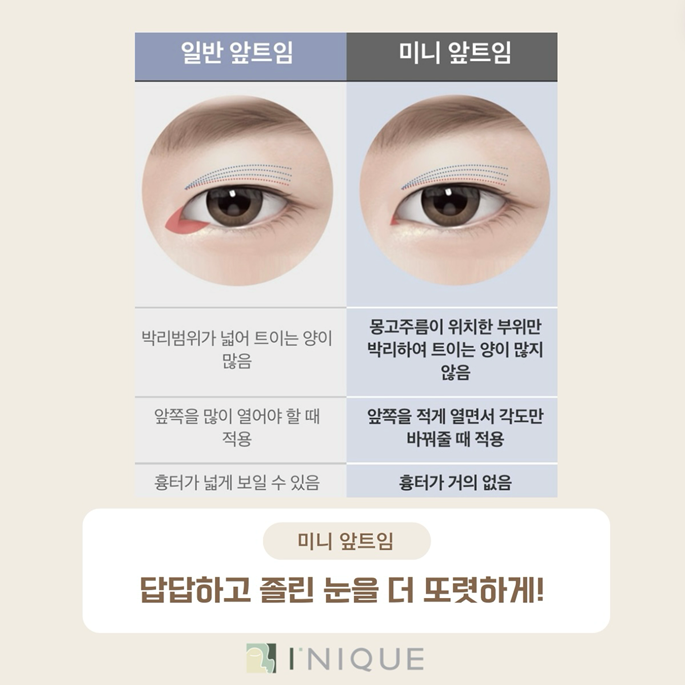 Inner Corner Eye Surgery Recommendation: Who Is It Suitable For? image 3