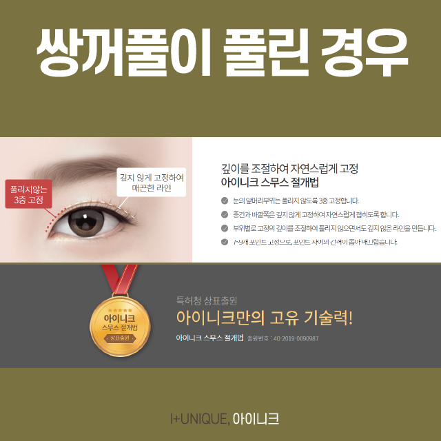삼꺼풀해결방법, 원인 파악부터 제대로! 관련 이미지 3