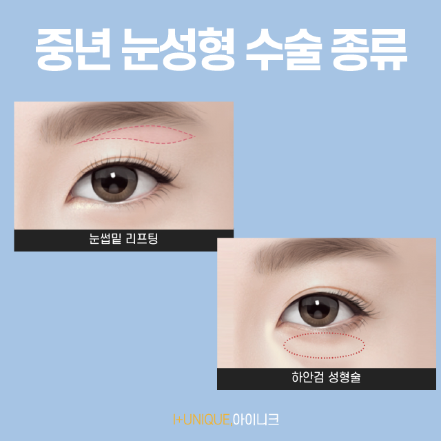 부모님을 위한 눈처짐 수술, 제대로 알고 해요 관련 이미지 2
