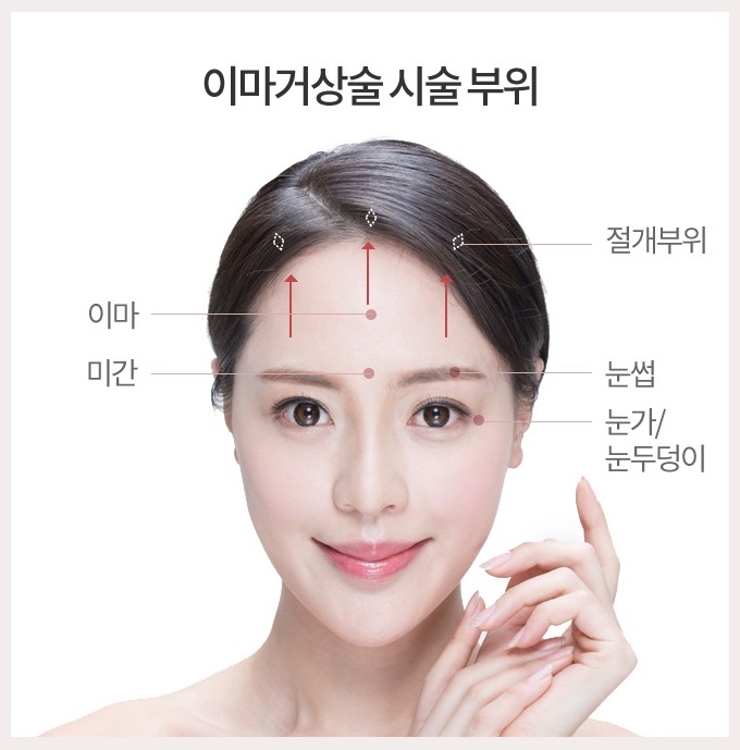 이마거상술비용 신중하게 알아보자 관련 이미지 5