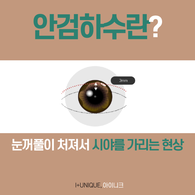 비절개눈매교정 꼼꼼하게 병원을 선택해야 하는 이유 관련 이미지 3