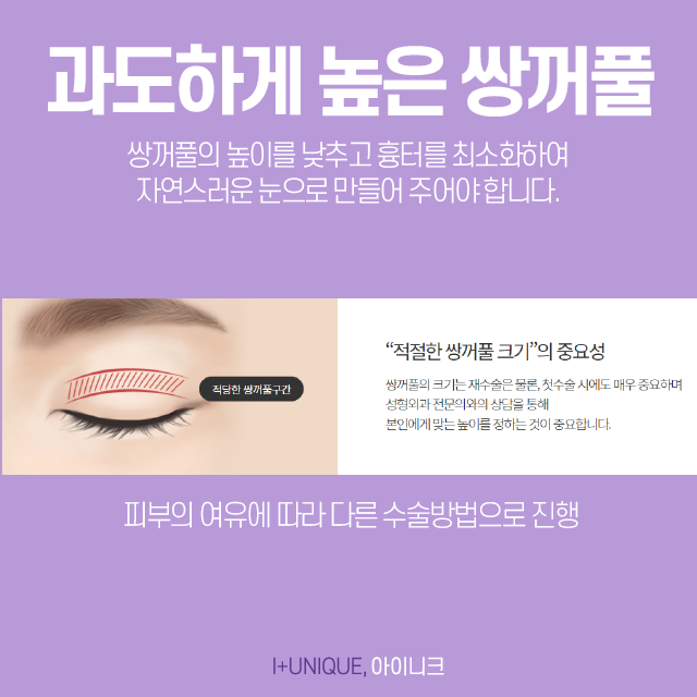 쌍꺼풀제수술잘하는곳을 찾는다면 아이니크만한 곳이 없죠 관련 이미지 4