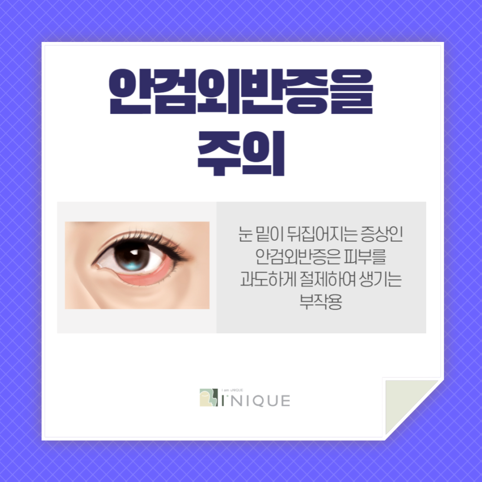 Double Eyelid Surgery in Your 40s, This Is the Perfect Option for Middle Age! image 5