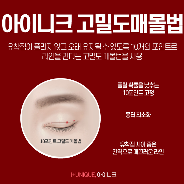 쌍꺼풀잘하는곳 여기로 결정하자! 관련 이미지 4