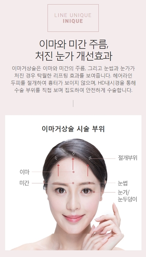 이마거상술비용 맞춤 상담으로 꼼꼼하게 체크하세요! 관련 이미지 2