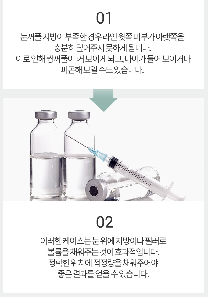 쌍커플재수술비용 원인별 맞춤 솔루션 제공! 관련 이미지 7