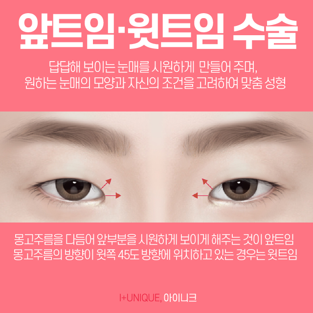 앞트임잘하는곳 아이니크에서 알려주는 수술방법 관련 이미지 2