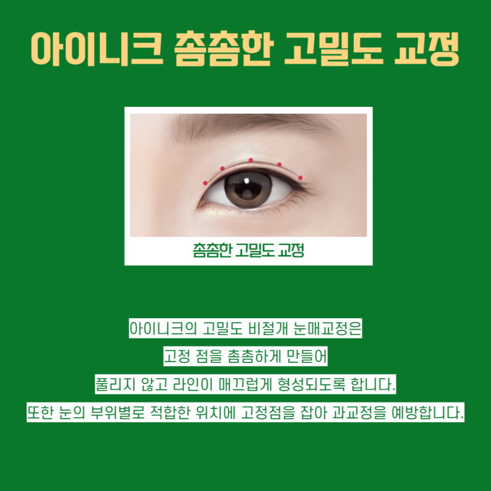 Points to Note for Male Eye Surgery image 5