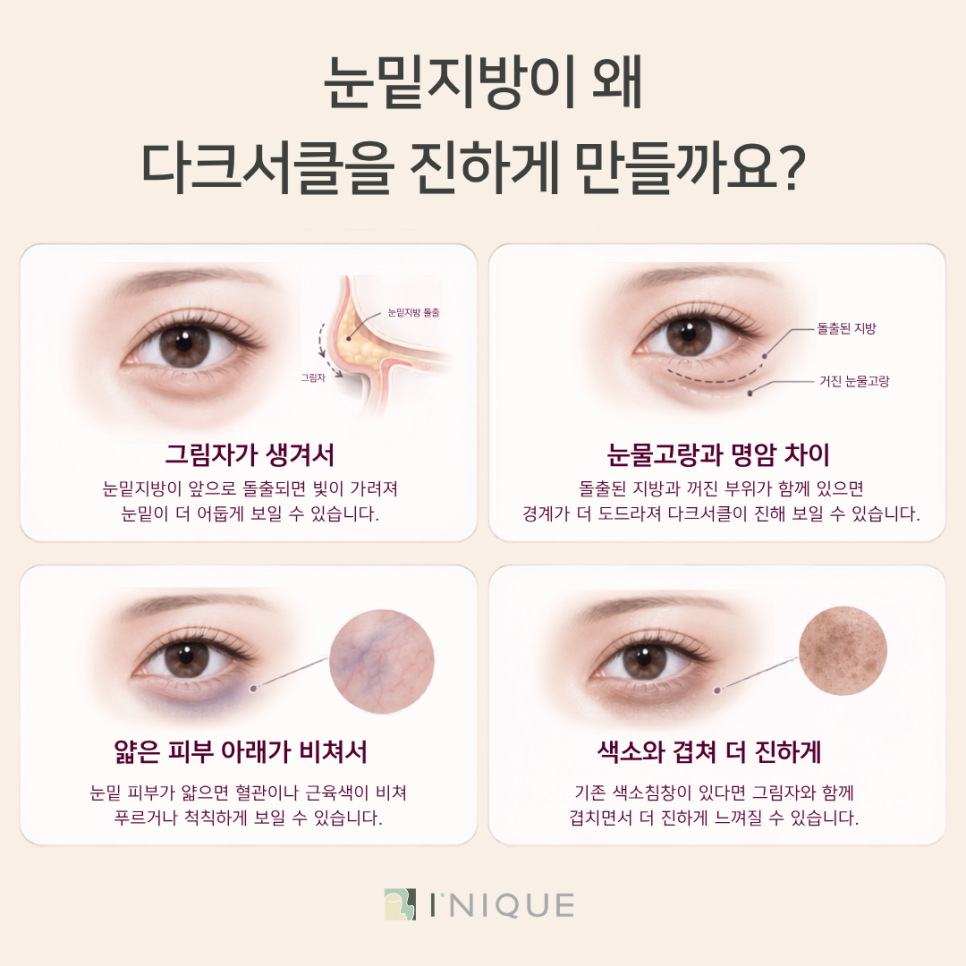 눈밑에다크서클, 눈밑지방이 원인일 수도 있을까요? 관련 이미지 3
