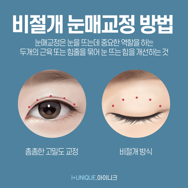 졸린눈고민 방치하면 위험할수도 있습니다 관련 이미지 4