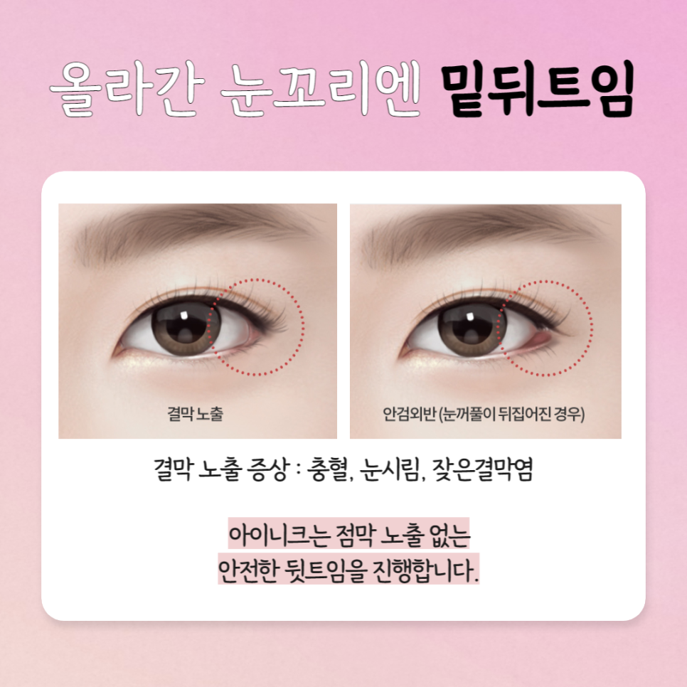 The Best Place for First-Eye Surgery Is Right Here image 6
