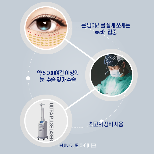 눈밑지방제거 주의사항 및 관리방법 관련 이미지 5