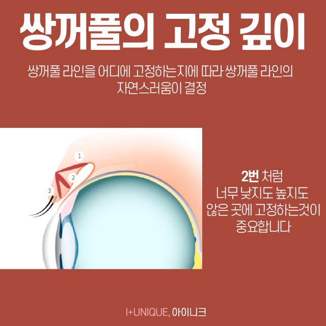 쌍꺼풀잘하는곳에는 다 방법이 있다, 어떤 것이 있을까 관련 이미지 4