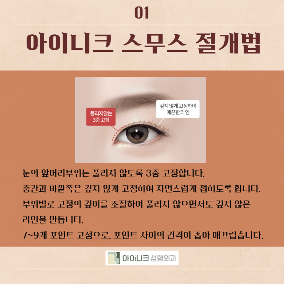 강남눈수술, 이곳이 답! 관련 이미지 3