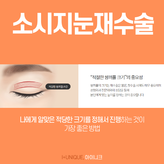 소시지눈재수술 고민한만큼 신중하게! 관련 이미지 3