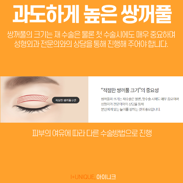 눈성형재수술, 어떻게 하면 자연스럽게 되돌릴 수 있을까 관련 이미지 4