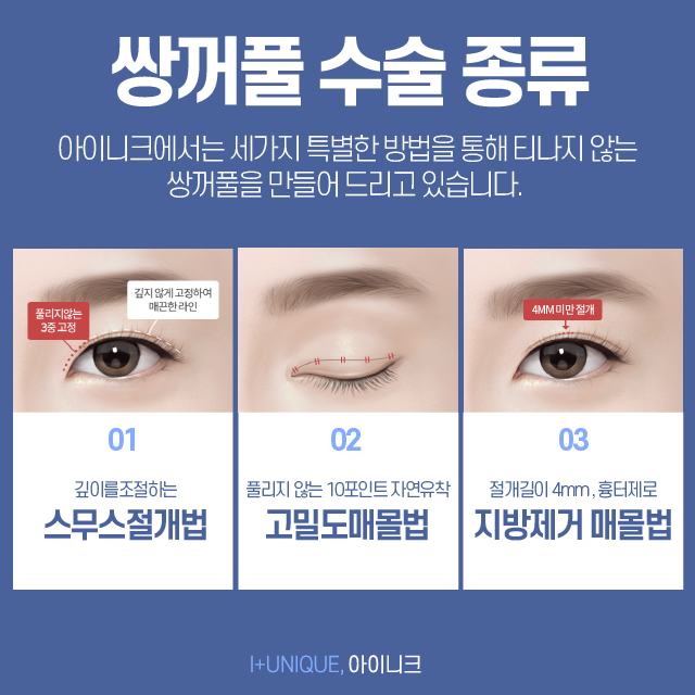 내 눈에 맞는 쌍꺼풀수술종류는 따로있다 아이니크성형외과에서 알아보자 관련 이미지 3