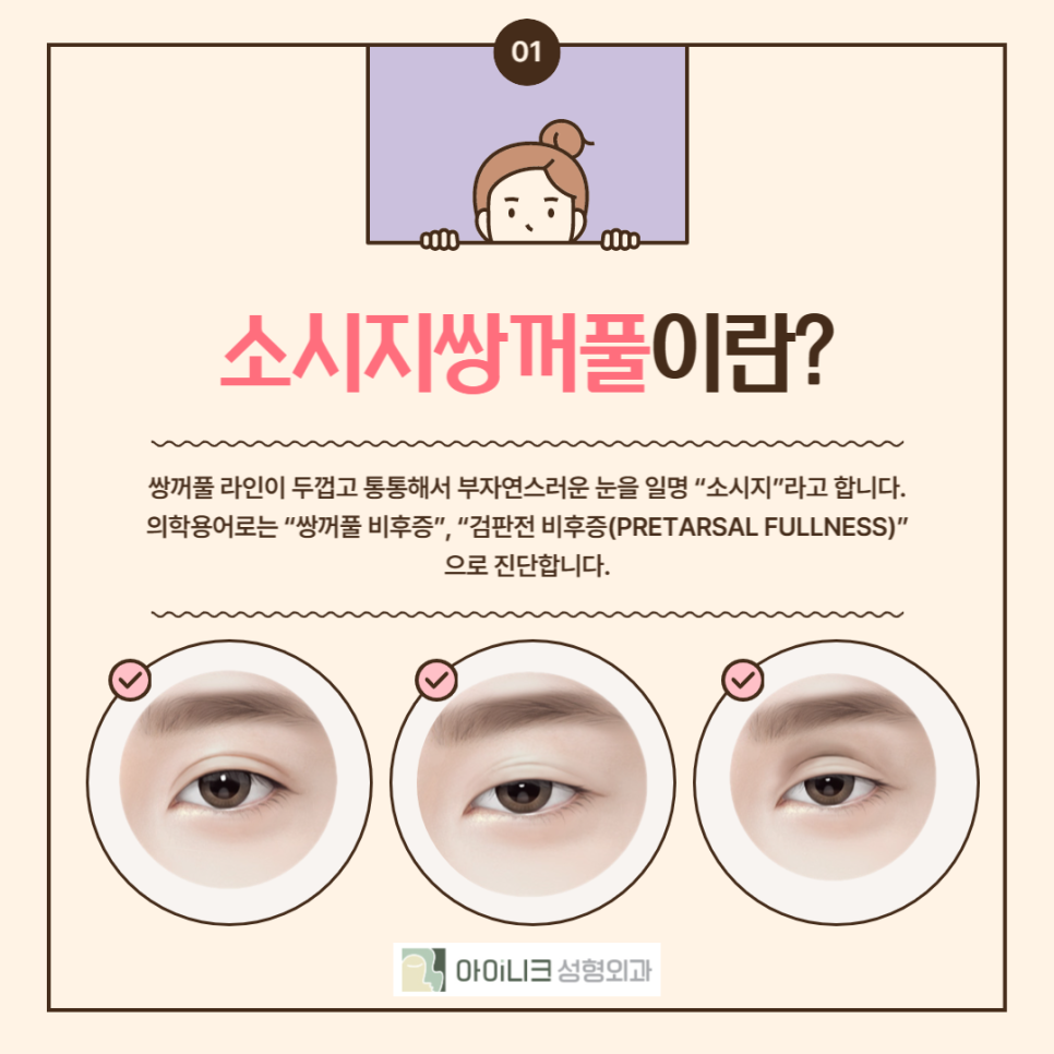 If You’re Looking for a Place That Specializes in Revision Eyelid Surgery, Take Note! image 2