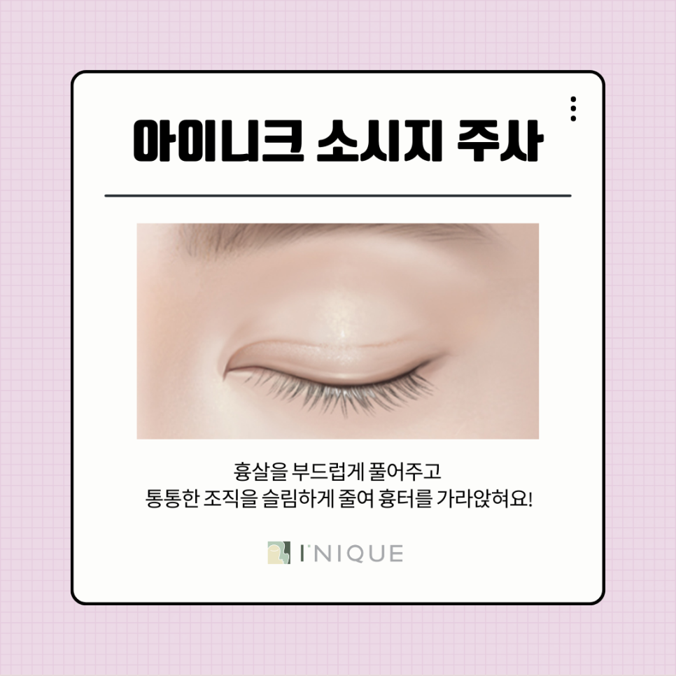 쌍꺼풀 절개 흉터 없애는 법과 관리법 총정리! 관련 이미지 6