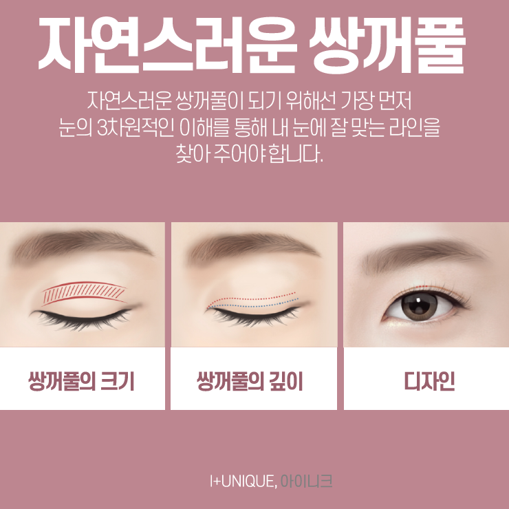 눈수술잘하는곳을 알아보려면 아이니크성형외과와 이것부터 알아보자 관련 이미지 2