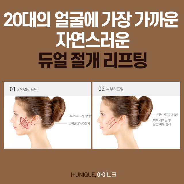 흘러간 세월을 잡는 안면거상술, 유지 기간부터 비용까지 관련 이미지 4