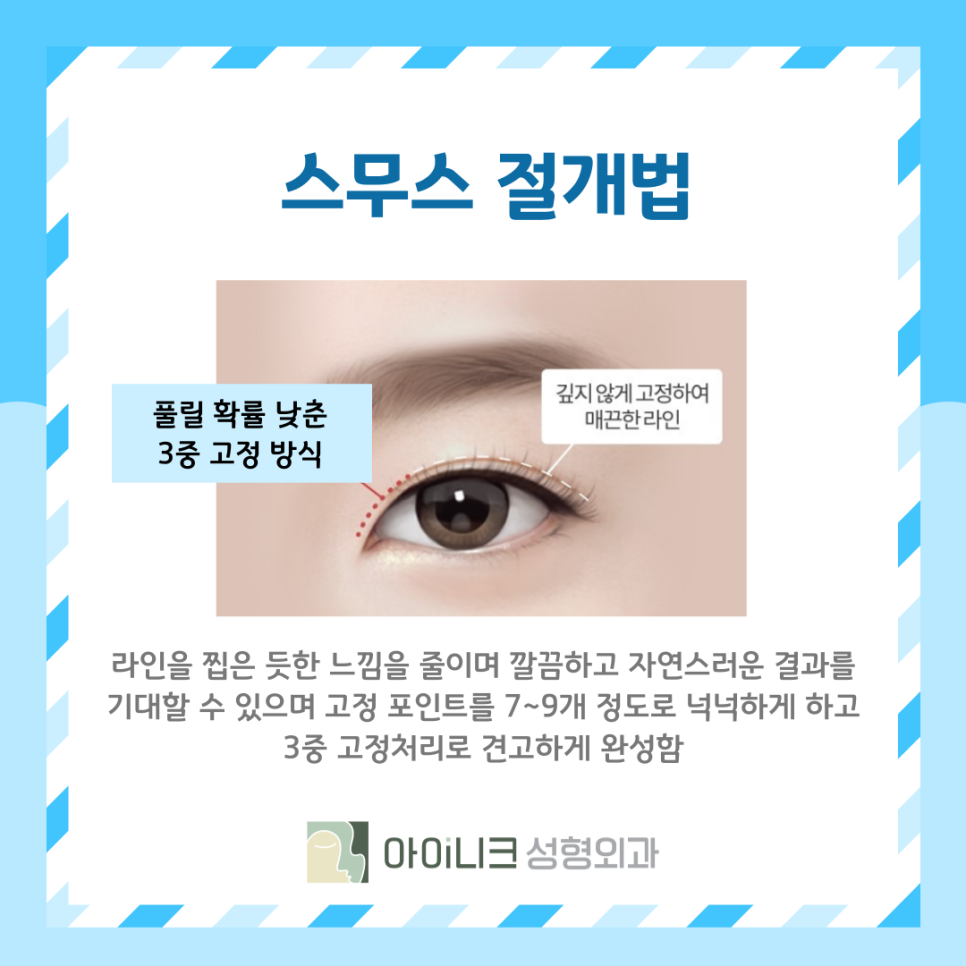 What Is the Right Choice Among Double Eyelid Surgery Types: Suture or Incisional? image 12
