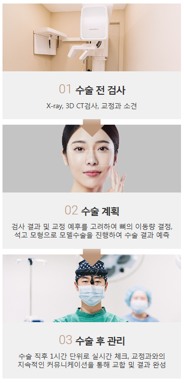 남자양악수술비용과 방법 확인해보세요! 관련 이미지 5