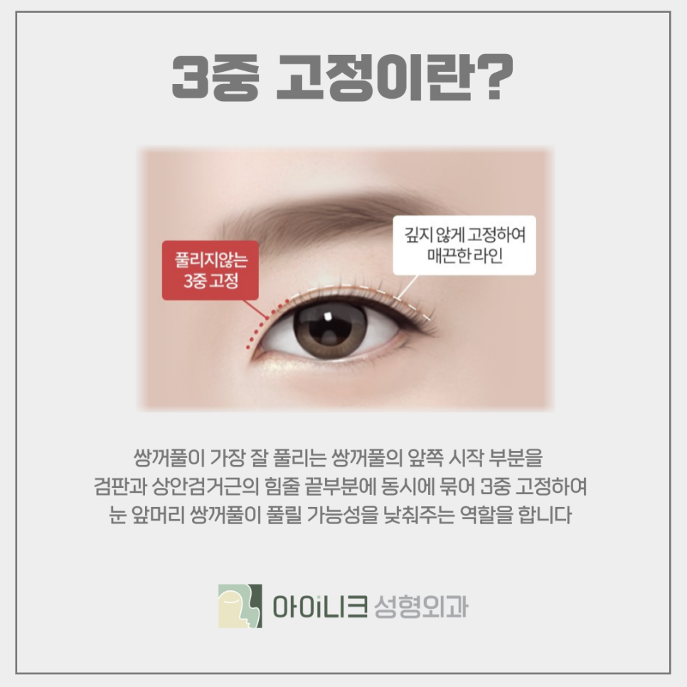 압구정 쌍꺼풀 라인 디자인 개인의 타고난 피부결에 따라 관련 이미지 7
