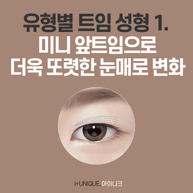 트임 성형의 종류, 그리고 트임 후기! 관련 이미지 2