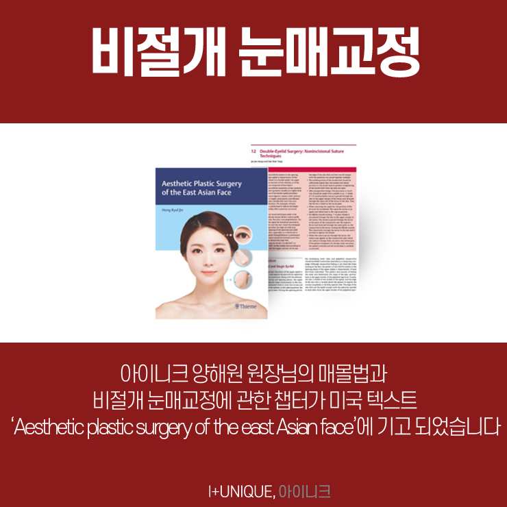 남자눈매교정병원 아이니크성형외과에서 알려주는 자연스러운 눈성형방법 관련 이미지 5