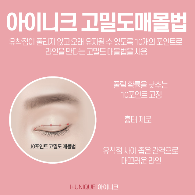 쌍수성형외과추천 받을 때 가장 중요한 것은 이것! 관련 이미지 4