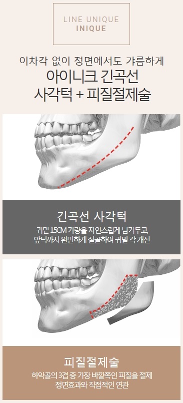 사각턱재건 실패 없이 완성된 얼굴 관련 이미지 2