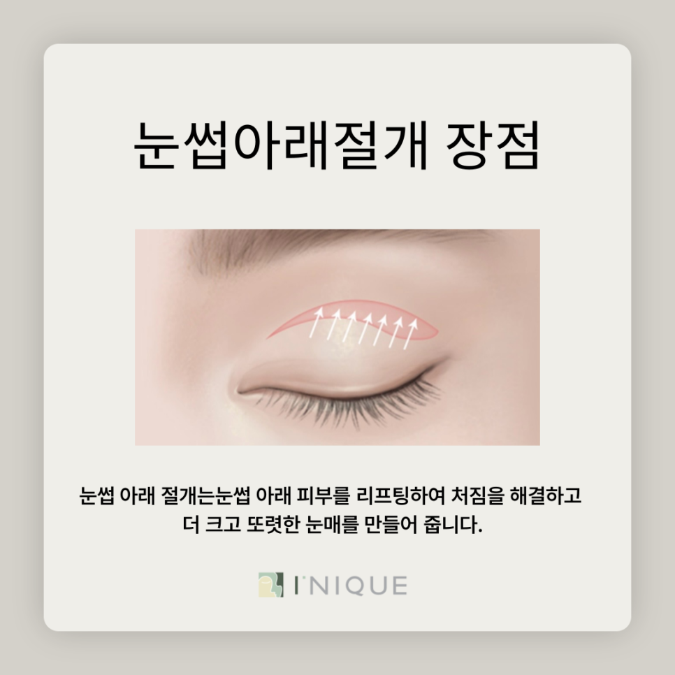 눈썹아래절개로 생기 되찾기 관련 이미지 5