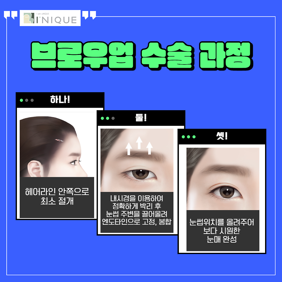A Review of Creating a Clearer, Fresher Impression with Brow Lift Surgery image 3