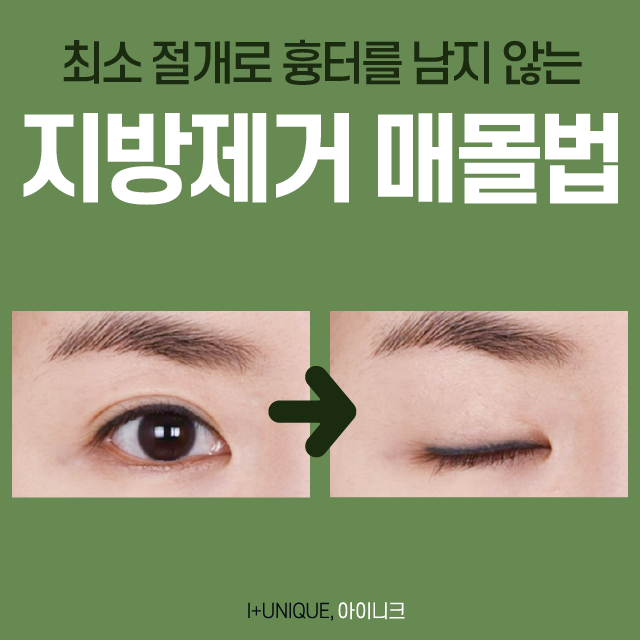 수험생들 모두 모여라! 쌍수절개법, 매몰법 할인 이벤트 진행 중 관련 이미지 5