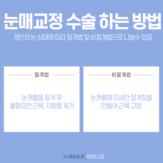 서울눈매교정 반드시 해야할까요? 관련 이미지 5